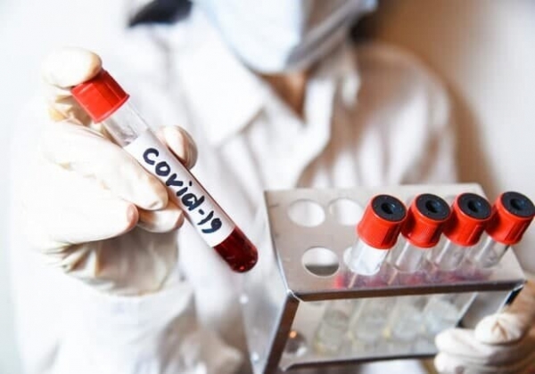24 смерти за сутки: какая статистика Covid-19 в Одесской области (обновлено)