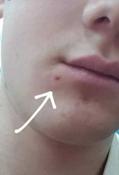 У Мелітополі підліток «по приколу» відкрив прямо в школі стрілянину по дітях і потрапив одному з учнів в обличчя