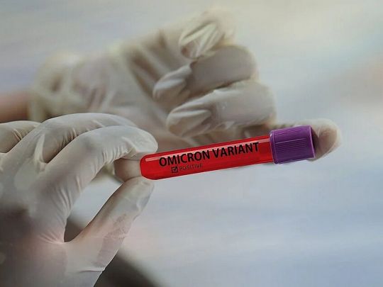 Про штам «Омікрон», його симптоми та перебіг хвороби розповість лікар-інфекціоніст