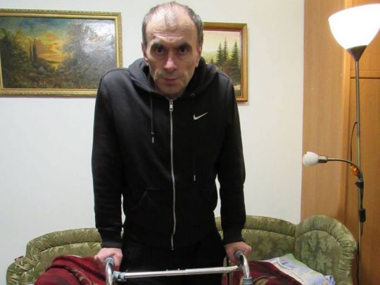 «Пацієнт два роки пересувався навприсядки — його коліна були зігнуті під кутом 90 градусів»: після складних операцій чоловік знову вчиться ходити