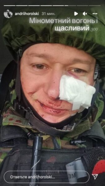 Лидер &laquo;Бумбокса&raquo; Андрей Хлывнюк получил осколочное ранение