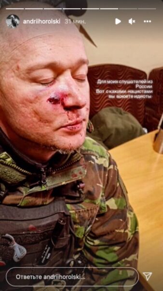 Лидер &laquo;Бумбокса&raquo; Андрей Хлывнюк получил осколочное ранение