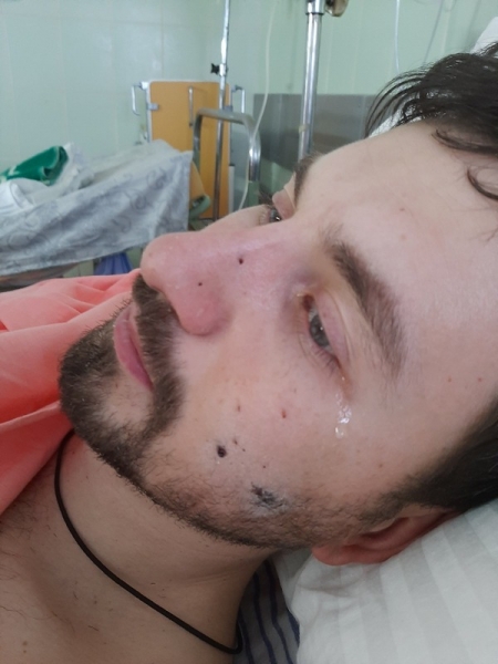 «Кулі влучили у ноги, легені, печінку»: важкопоранений оперний співак на машині евакуював людей з Харкова
