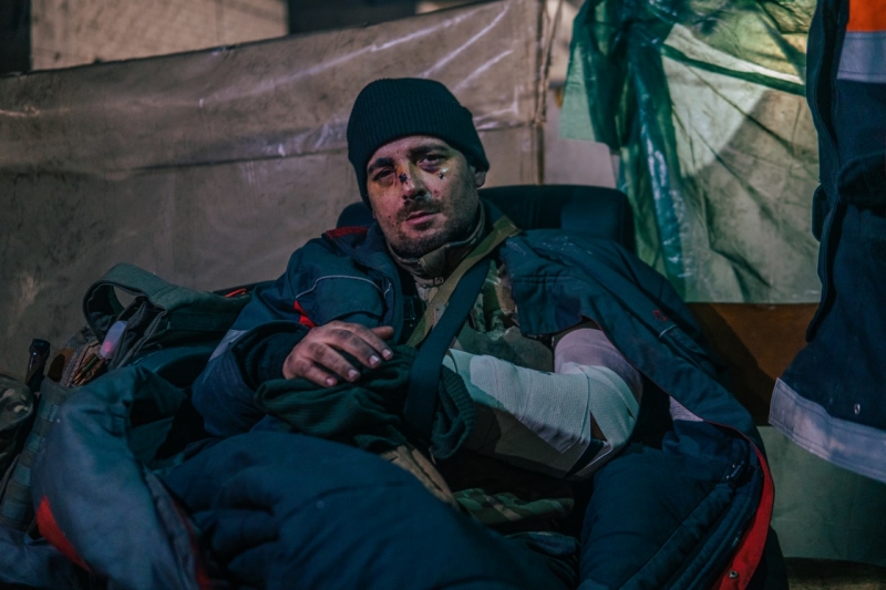 Скалічені, та незламні: «Азов» показав вражаючі фото захисників Маріуполя та звернувся до ООН