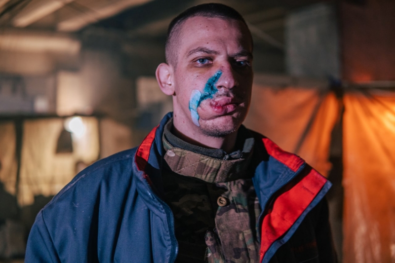 Скалічені, та незламні: «Азов» показав вражаючі фото захисників Маріуполя та звернувся до ООН