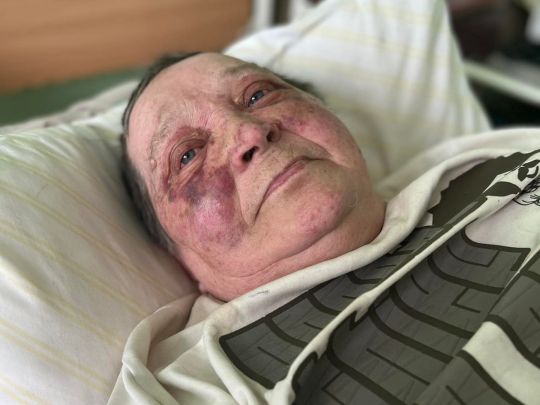 &laquo;Втекла дивом&raquo;: рашисти ледь не&nbsp;до&nbsp;смерті побили пенсіонерку через український паспорт