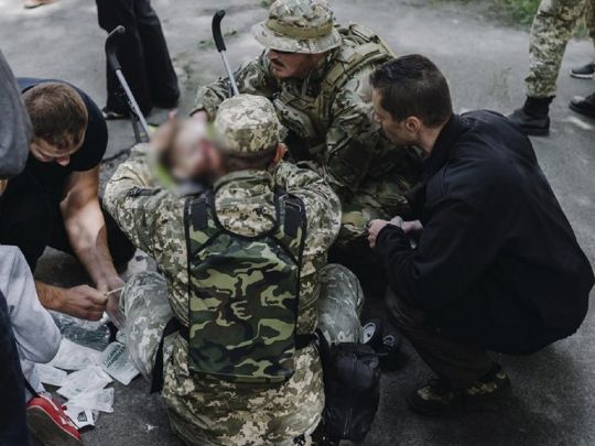 На виставці зброї у Чернігові спрацював гранатомет, поранено дітей (фото)