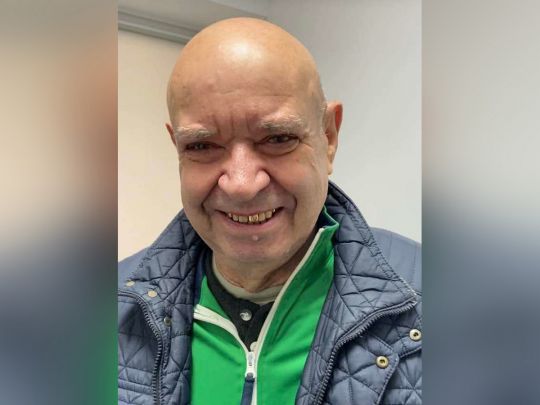 «Аби викопати картоплю, виніс з городу 12 мін, 13-та — вибухнула»: медики розповіли, як врятували пенсіонера з Донеччини