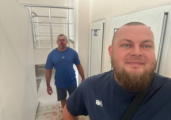 В Одессе фитнес-тренер "послал" военного: его нашли и разбили ему лицо