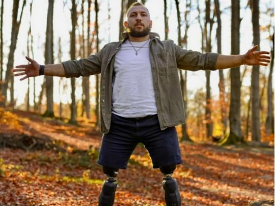 «Немає гострішого болю, ніж біль твоєї дитини»: ветеран війни, який втратив обидві ноги, б’ється за життя своєї дочки