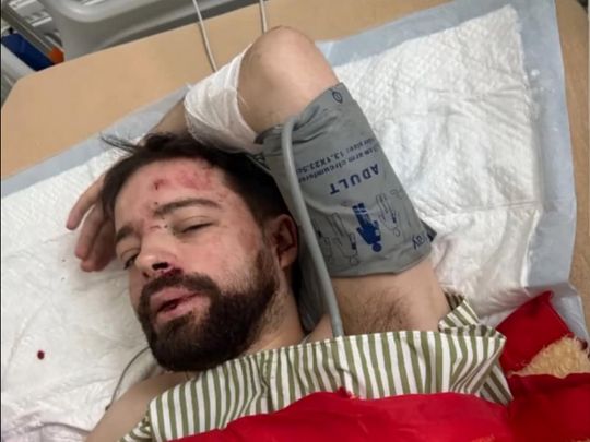Викладача львівського університету знайшли під Києвом у&nbsp;критичному стані нібито після &laquo;викрадення&raquo; співробітниками ТЦК (фото)